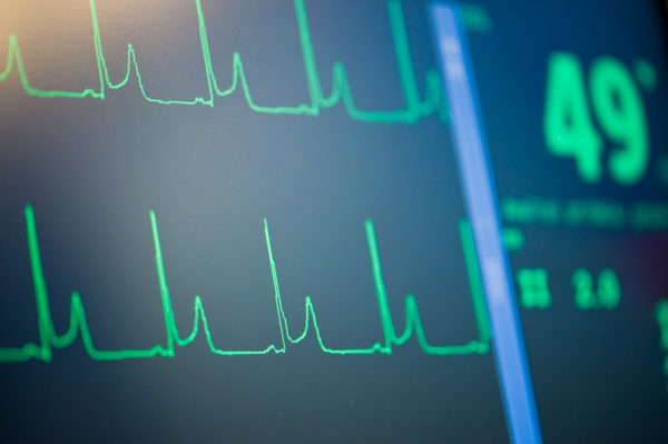 Ecocardiogramma ECG